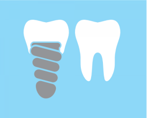 'dental implant and tooth'
