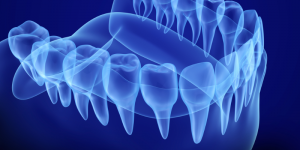 picture of jaw bone 